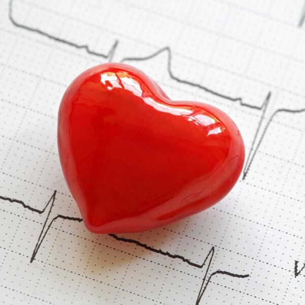 Electrocardiograma